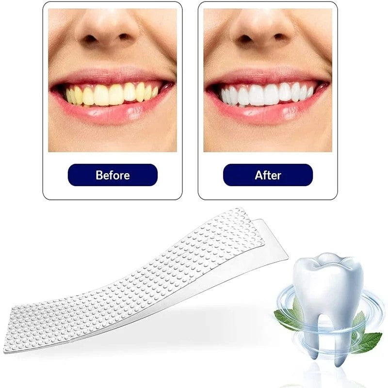 Fitas Clareadoras 5D para os Dentes